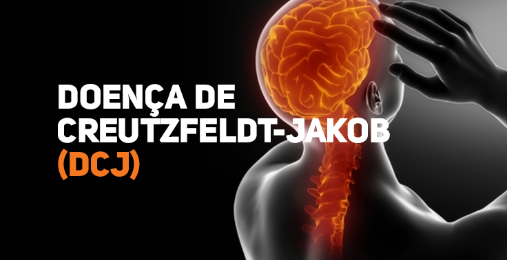 Ilustração sobre a Doença de Creutzfeldt-Jakob (DCJ). À esquerda, em fundo preto, aparece o texto em destaque: 'DOENÇA DE CREUTZFELDT-JAKOB (DCJ)', com o nome da doença em branco e a sigla em laranja. À direita, há a imagem de uma pessoa vista de costas, com o cérebro e a medula espinhal destacados em tons de laranja brilhante, enquanto uma das mãos toca a cabeça, sugerindo um problema neurológico. A composição utiliza contraste entre preto, branco e laranja para enfatizar o tema.
